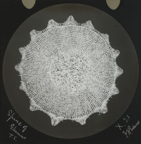 Black and white photograph. Resembling a doily, this cross section of a sea urchin has lines radiating from what looks like a cluster of bubbles at the centre, and a scalloped edge. Handwritten notes appear in the lower corners.
