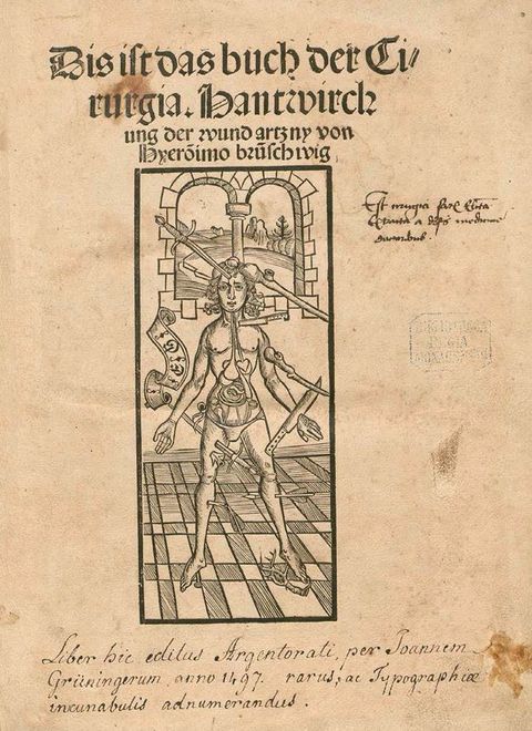 Illustration. This frontispiece for a book consists of a central vignette showing a man poked, sliced, and clubbed by swords, daggers, knives, arrows, and a branch. The skin over his torso is removed to show organs there. He stands on a checkered floor in front of a double window. Text in German is printed above the vignette and a handwritten note is below.