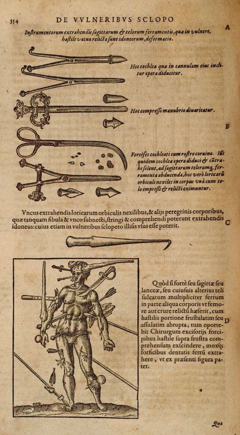Illustration. Instruments used to extract bullets, bullet fragments and arrowheads are lined up in the top half of this page. A man struck and sliced through with daggers, swords, clubs, and other weapons is below.
