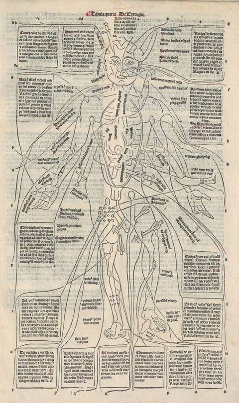 Illustration. A man has been poked, cut, sliced, stabbed, and scraped with knives, daggers, spears, arrows, and branches. Body parts have been labelled, and boxes of text surround the body.