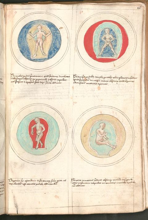 Illumination. Four views of pale-skinned babies in different positions in wombs painted as rings of royal or aqua blue, red, or straw yellow. Two or three lines of writing are under each image.