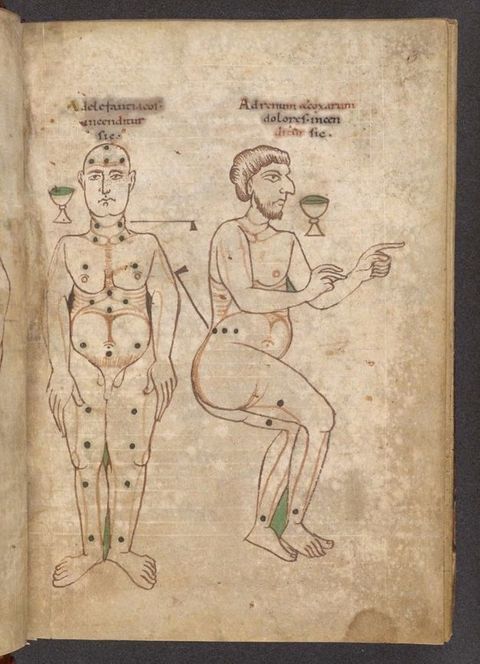 Illumination. Two nude men, one standing and one in a seated posture, have points for bloodletting marked on their bodies with black spots.