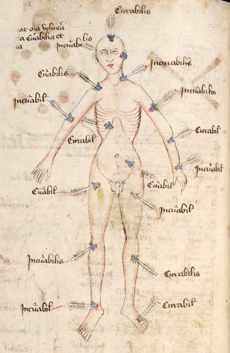 Illumination. A bald, nude man is pierced with blue-tipped arrows, each labelled “curabiles” or “incurabiles”.