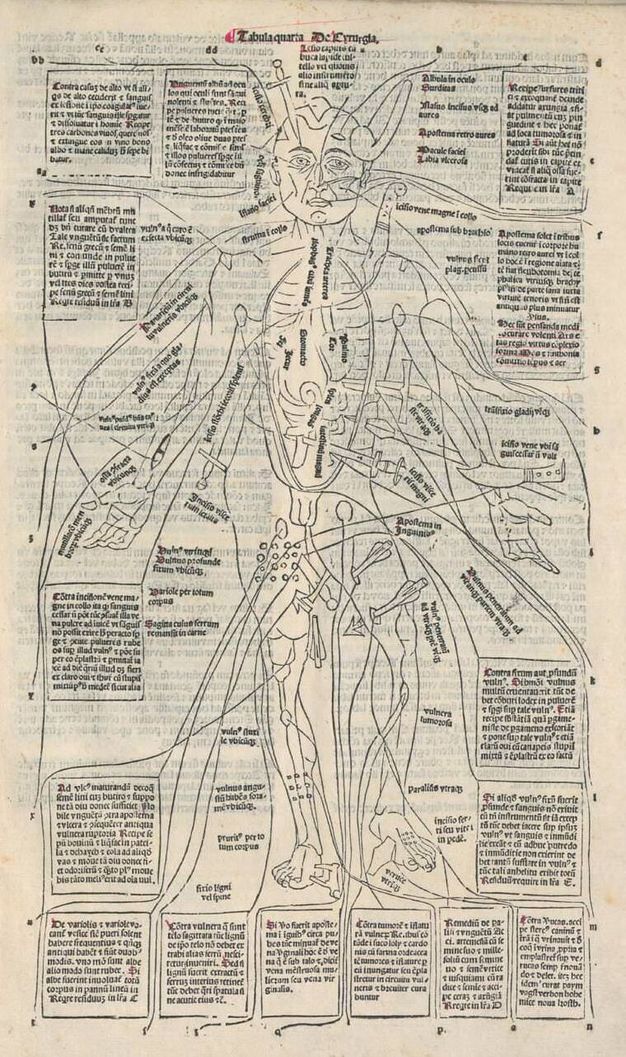 Illustration. A man has been poked, cut, sliced, stabbed, and scraped with knives, daggers, spears, arrows, and branches. Body parts have been labelled, and boxes of text surround the body.