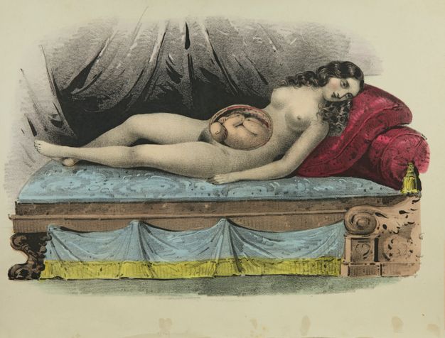 Illustration. A nude pale-skinned, dark-haired woman lies back along a sofa with her face turned towards us. Layers over her belly have been cut away to show a baby in utero in this hand-coloured lithograph.
