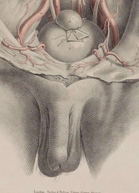 Illustration. Detail view of a hairless penis and testicles, the latter of which has some straggly strands of pubic hair. Above is the bottom of the dissected torso.