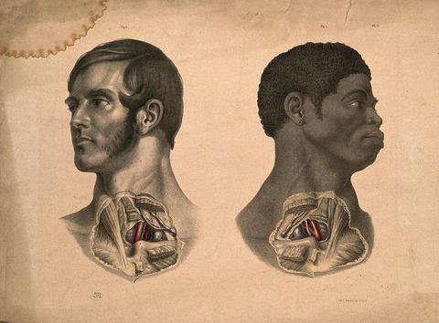 Illustration. Roughly round patches of skin covering the lower neck head and upper chest of two men, one white and one Black, are removed to show muscles, organs, and tissues. The white man is to our left, and his open eyes look in that direction. The Black man is to our right, eyes also following that direction. The exposed organs are mirrored.