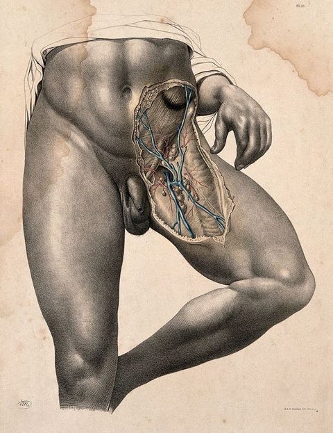 Illustration. The lower abdomen and upper thigh of a muscular nude man have been exposed. Arteries and veins are blue and red.