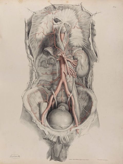 Illustration. A man’s torso down to the bladder has been dissected. Arteries are coloured with red. The penis and testicles hang alone below, beyond the space of the dissected area.