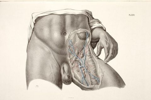 Illustration. A man’s torso is shown from above the belly button to upper thighs. Skin has been removed from an area over the left pelvis, to our right. The hand on that side rests with middle fingertip gently grazing the skin, the pointer finger tucked behind.