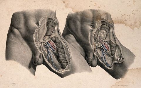 Illustration. The left lower abdomens, hips, and upper thighs of two men are shown from just above the belly button to mid-thigh. The dissected thigh of the left person overlaps the untouched thigh of the other. The example on the right shows deeper dissections, and a few parts are coloured in red and blue in both.