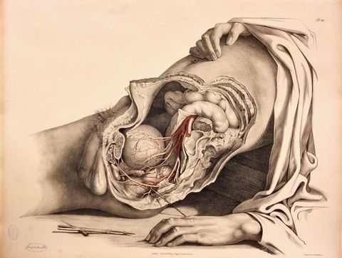 Illustration. With one leg removed, a dissected pelvis encompasses the intestines at the top to just behind the penis. The man’s torso is laid back on a ledge or block. One of the man’s hands rests on his chest, and the other is by his side near a sharpened crayon in a metal holder.