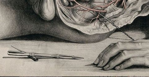 Illustration. Detail view of a sharpened crayon in a metal holder next to the hand and dissected abdomen and pelvic area of a man.