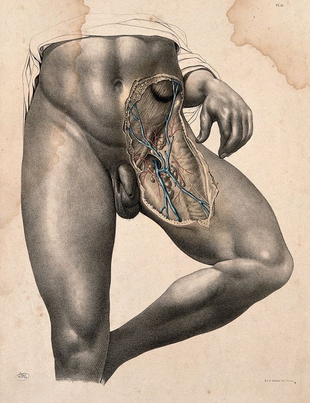 Illustration. The lower abdomen and upper thigh of a muscular nude man have been exposed. Arteries and veins are blue and red.