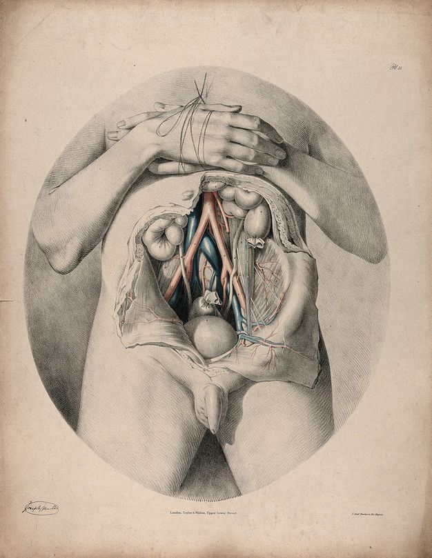 Illustration. Set within an oval frame, a man’s abdomen has been cut open so flaps of skin lie to each side. Some body parts are coloured in red or blue. The hands, one on top of the other, are tied together over the chest.