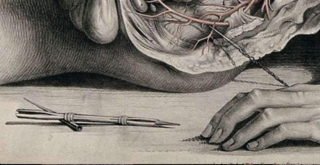 Illustration. Detail view of a sharpened crayon in a metal holder next to the hand and dissected abdomen and pelvic area of a man.