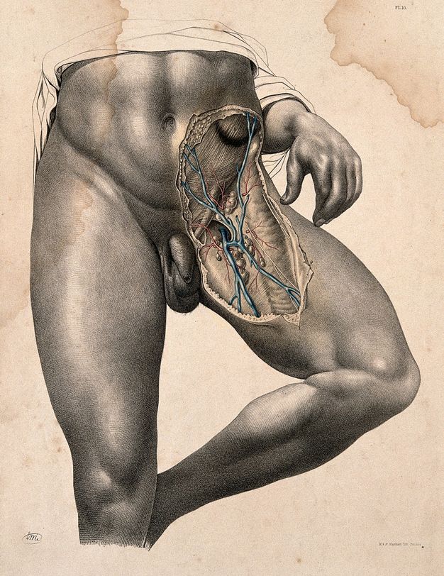 Illustration. A man’s muscled body is shown from mid-torso down. The area of his left hip to mid-thigh is exposed, some areas coloured blue or red. That leg bends so the foot tucks behind the knee of the other leg, which is straight. The man’s left hand brushes the dissected thigh. Drapery is outlined around the torso and arm.