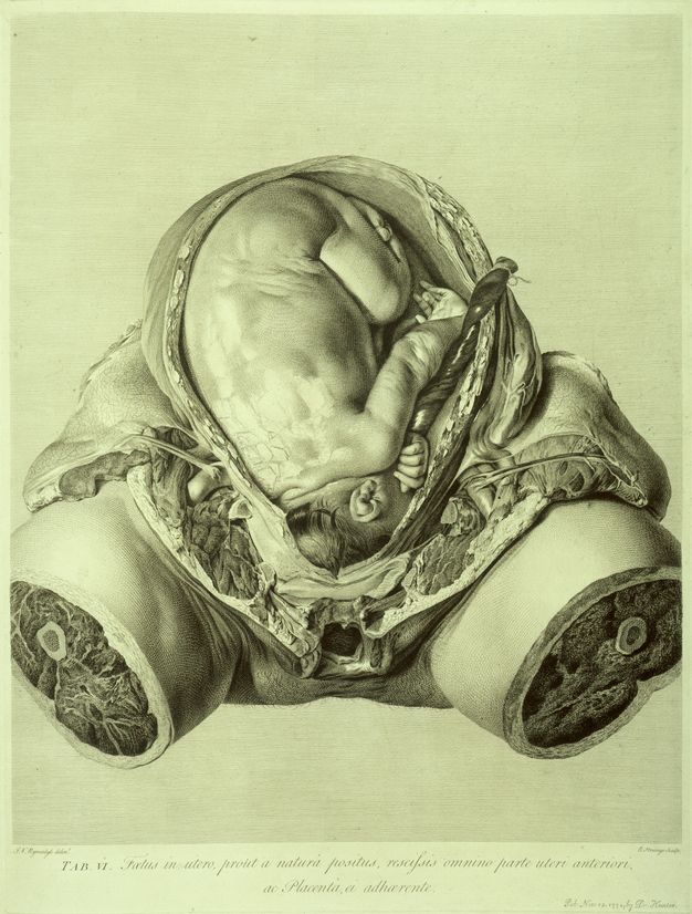 Illustration. A baby tucked tightly into a woman’s womb. Only the womb, the flayed area around the hips, and the upper legs are visible. The legs are shown as if cut clean through, so cross sections of bones, muscle, and other tissue are exposed.