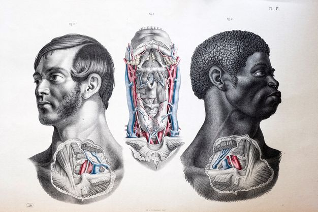Illustration. Roughly round patches of skin covering the lower neck head and upper chest of two men, one white and one Black, are removed to show muscles, organs, and tissues. The exposed organs are mirrored. Between them, a third illustration shows a dissected neck from the collarbone to the lower teeth. Parts of all three are coloured in red or blue.