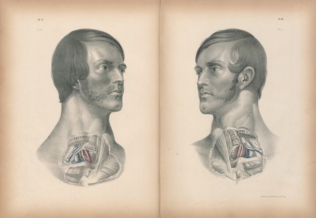 Illustration. On facing pages, the skin over the throat and upper chest of two pale-skinned men has been removed and some vessels painted red and blue. They have similar facial features, including clefts in their chins. They both have mutton chops, but only the mutton chops on the man to our left connect to a moustache.