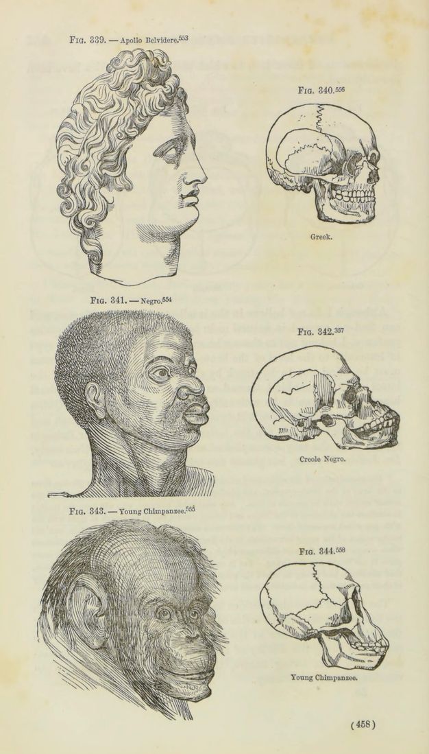 Illustration. Three heads are next to corresponding skulls. The top bust is labelled “Apollo Belvedere”. The skull shows a straight drop from the nasal bone to the chin. The middle bust is labelled “Negro”, and his bulbous nose and mouth are exaggerated. The slope from the small cranium of the skull is shallow, so the teeth are nearly on a level with the nasal bone. The third, labelled “Young Chimpanzee”, has a round skull and a diagonal slope from nasal bone to teeth.