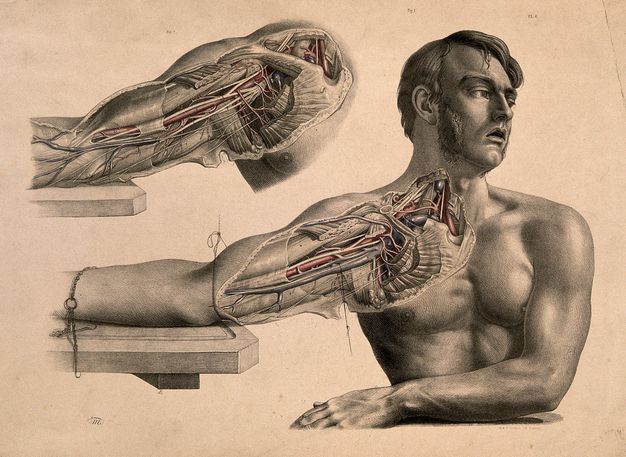 Illustration. Two views of dissected shoulders and upper arms. In the more complete illustration, below, a man appears to sit with his right arm, to our left, tied to a table. His head turns to our right, eyes open and mouth slack. His other arm rests across his torso. Here and in the detail view above, the area from just below his chin to elbow has been dissected, some areas coloured in red or blue.