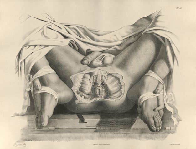 Illustration. A man lies on his back with his knees deeply bent so his hands are tied to, and seem to caress, his feet. The area from behind the testicles to under the rectum is dissected. Drapery surrounding the legs is drawn in and partially shaded.