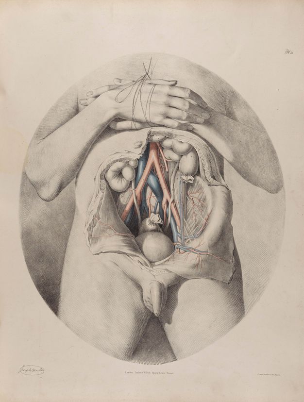 Illustration. Set within an oval frame, a man’s abdomen has been cut open so flaps of skin lie to each side. Some body parts are coloured in red or blue. The hands, one on top of the other, are tied together over the chest. A hairless penis and testicles cast a shadow onto the upper thighs below.