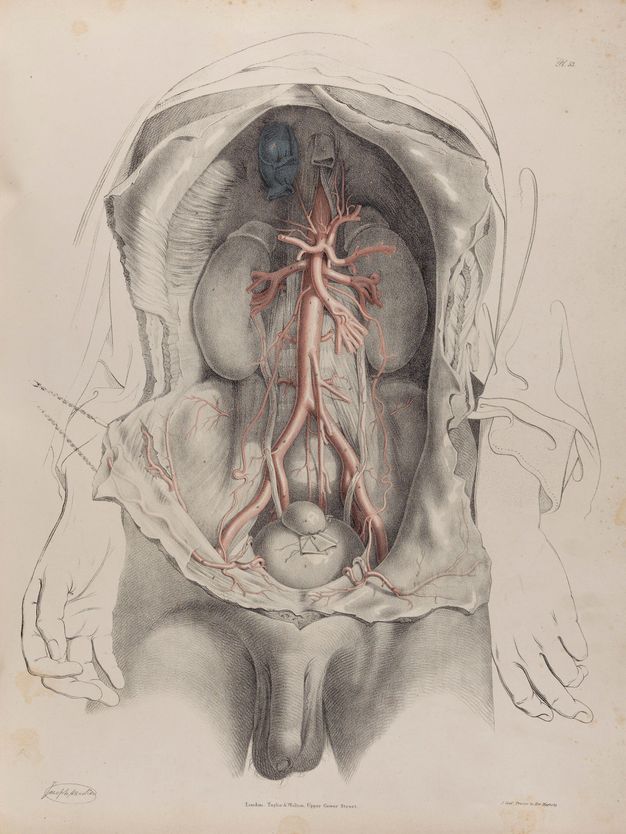 Illustration. The trunk of a man has been dissected, the flaps of skin pulled to each side to expose the arteries and surrounding organs. The penis and testicles hang between the upper thighs. Drapery around the incision and the man’s arms, which are by the sides, are outlined simply in black lines.