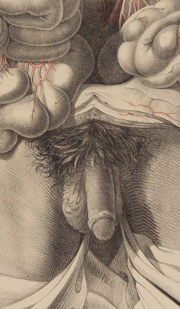 Illustration. Detail view of pubic hair, penis, and testicles below bulging intestines from a dissected area.