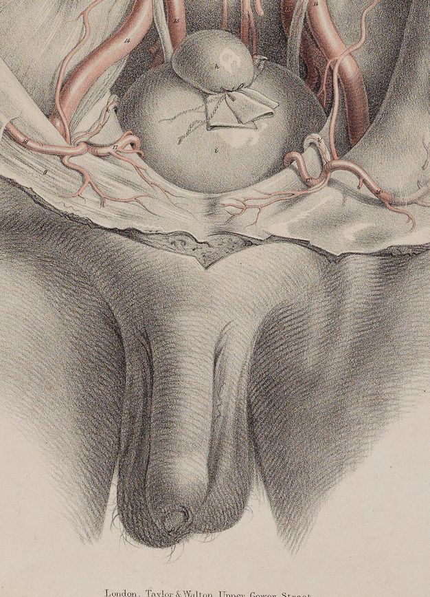 Illustration. Detail view of a hairless penis and testicles, the latter of which has some straggly strands of pubic hair. Above is the bottom of the dissected torso.