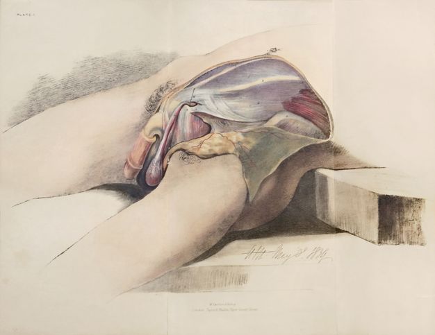 Illustration. This coloured lithograph shows the dissected pelvis of a man lying back on a ledge. The incision runs from alongside the penis to the lower abdomen.