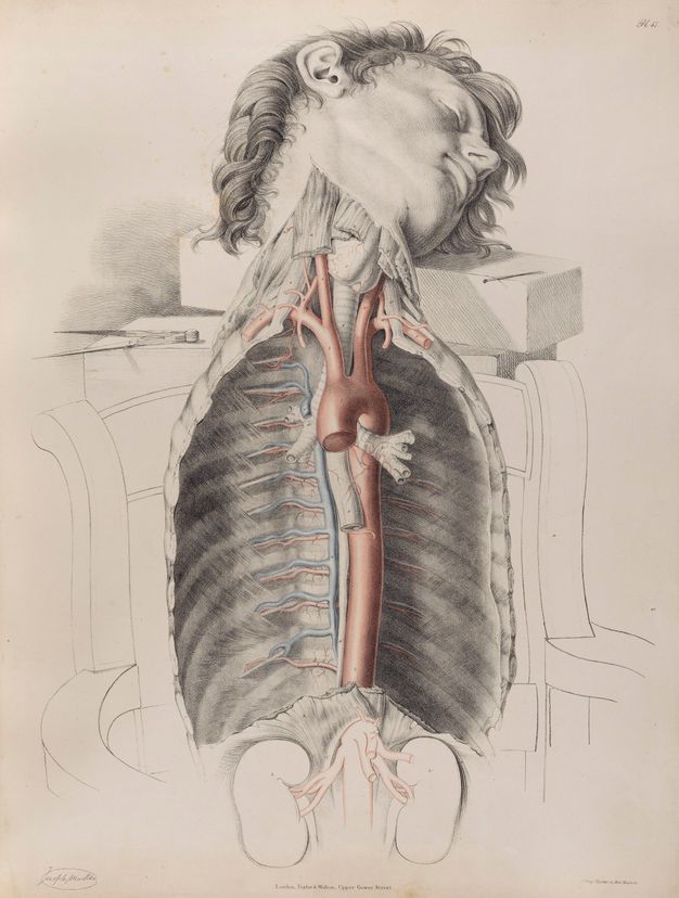 Illustration. A young, clean shaven man’s head rests on a block as the dissected chest cavity seems to rest, as if completely removed from the rest of the body, in the outline of a chair. Tissue and ligaments of the neck have been severed.