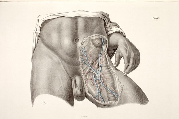 Illustration. A man’s torso is shown from above the belly button to upper thighs. Skin has been removed from an area over the left pelvis, to our right. The hand on that side rests with middle fingertip gently grazing the skin, the pointer finger tucked behind.