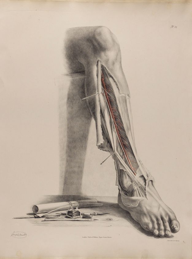 Illustration. A leg is shown from the knee down, as if bending down off a ledge. The skin is flayed from below the knee to the top of the foot, and is held open with pins. A scroll of paper, ink well, styli, and a knife are gathered on a wood surface on which the foot rests.