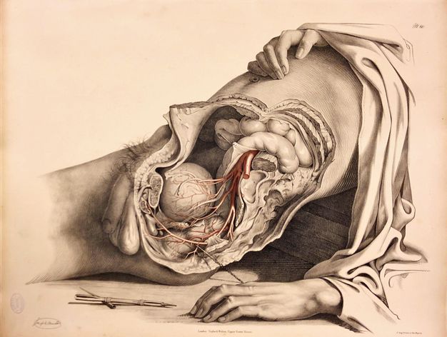 Illustration. With one leg removed, a dissected pelvis encompasses the intestines at the top to just behind the penis. The man’s torso is laid back on a ledge or block. One of the man’s hands rests on his chest, and the other is by his side near a sharpened crayon in a metal holder.