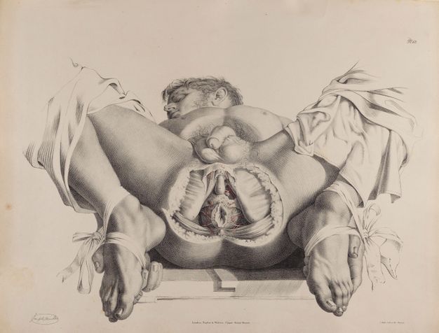 Illustration. A man lies on his back with his knees deeply bent so his hands are tied to and cradle his feet. The skin from just behind his testicles to behind the anus has been removed to expose organs and tissue. The man’s face falls to our left, his eyes closed.