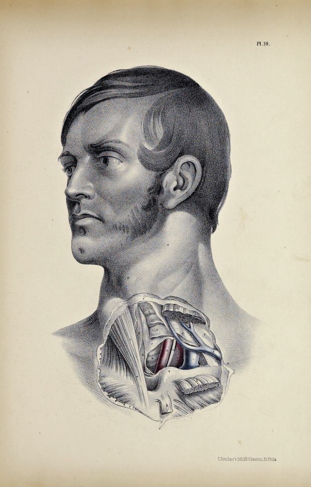 Illustration. Shown from the clavicle up, a man’s lower neck and upper chest are dissected. His pale-skinned face angles to our left. He has smooth, dark hair and mutton chops. His eyes are open and his lips closed. Veins are painted in blue and arteries red in the dissected area.
