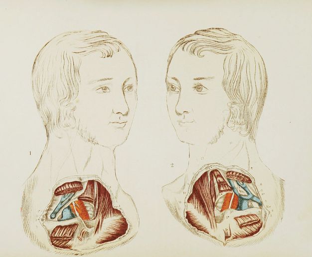 Illustration. Shown from the clavicles up, two men’s lower necks and upper chests are dissected. The men have similar features, and their faces angle towards each other, faintly smiling. Their faces are outlined in brown. The dissected areas are painted with blue and dark and vivid red.