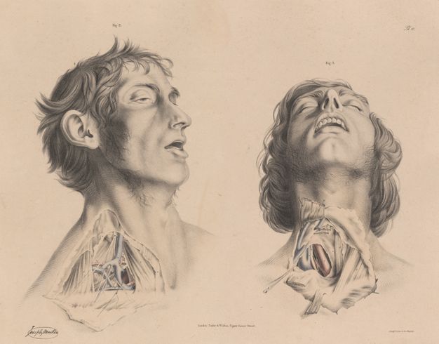 Illustration. Two men are shown from the shoulders up, each with their throat and neck dissected. Both are clean shaven with mutton chops, and their mouths are open. The man on our left is shown almost in profile facing our right, his eyes half open and his face slack. We look onto the underside of the other man’s chin as his head falls far back. His eyes are closed.