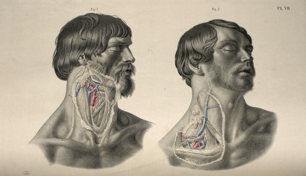 Illustration. Two men are shown from the clavicle up. Both heads face our right in profile or nearly so. Both have closed eyes and parted lips. To our left, the entirety of the side of a bearded man’s neck is dissected. Next to him, the second man has a shorter beard, and the dissected area covers his neck and over the clavicle.