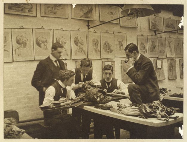 Black and white photograph. Three men dissect a cadaver as two more look on. The cadaver is only the chest, head, and arms, the latter stretched across a board. The three working students wear high collared, white shirts with the sleeves rolled up, ties, and vests. The two other men wear full suits and smoke pipes as they look on. The wall behind is almost covered in anatomical illustrations.