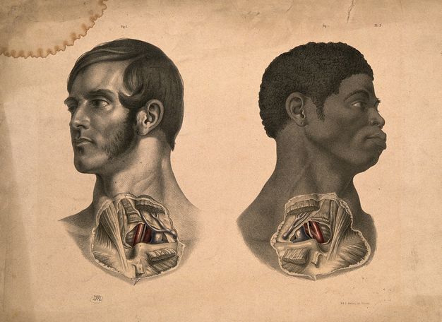 Illustration. Roughly round patches of skin covering the lower neck head and upper chest of two men, one white and one Black, are removed to show muscles, organs, and tissues. The white man is to our left, and his open eyes look in that direction. The Black man is to our right, eyes also following that direction. The exposed organs are mirrored.