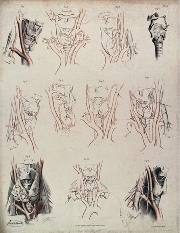 Illustration. Eleven diagrams and illustrations of the organs, vessels, and tissues of the throat and neck. The illustrations in the four corners are shaded in detail. The others are outlined in black and red. No recognizable external body parts, like chins or lips, are present.