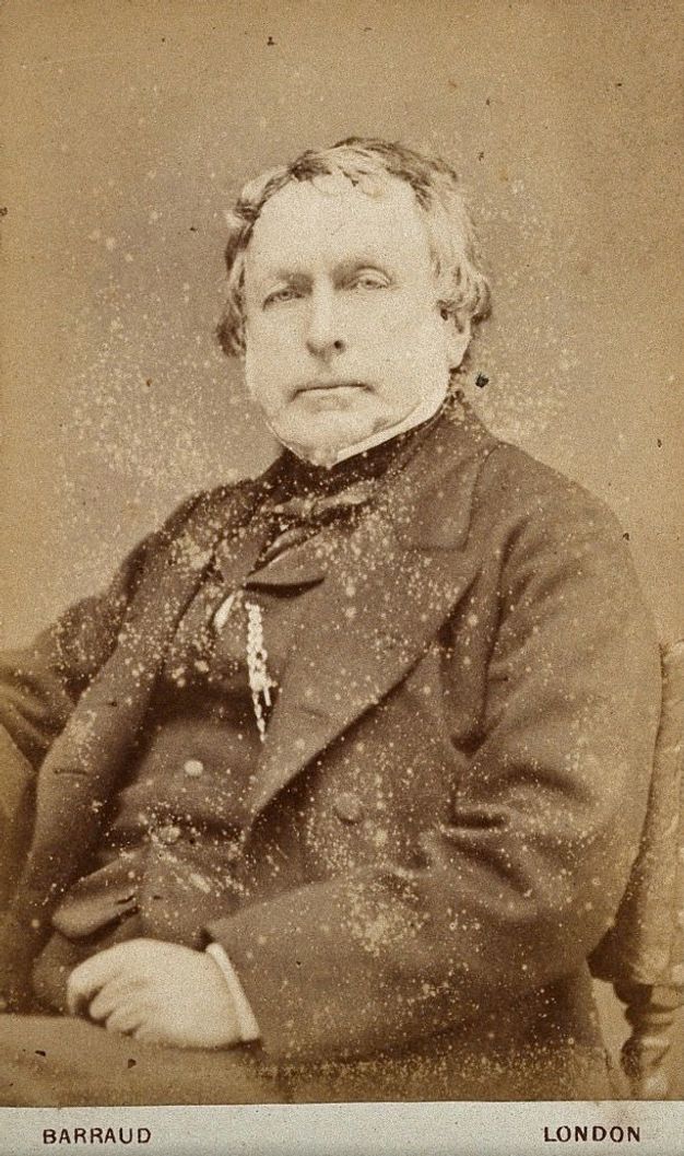 Black and white photograph. Shown from the waist up, a pale-skinned man sits looking at us. He has a high forehead, and his hair hangs long over his ears. His eyes are deeply set, he has a wide jaw, and his lips are set in a line. He wears a suit, and a pocket watch chain hangs on his vest. The photograph is scattered with tiny white dots, possibly either from age or the developing process.