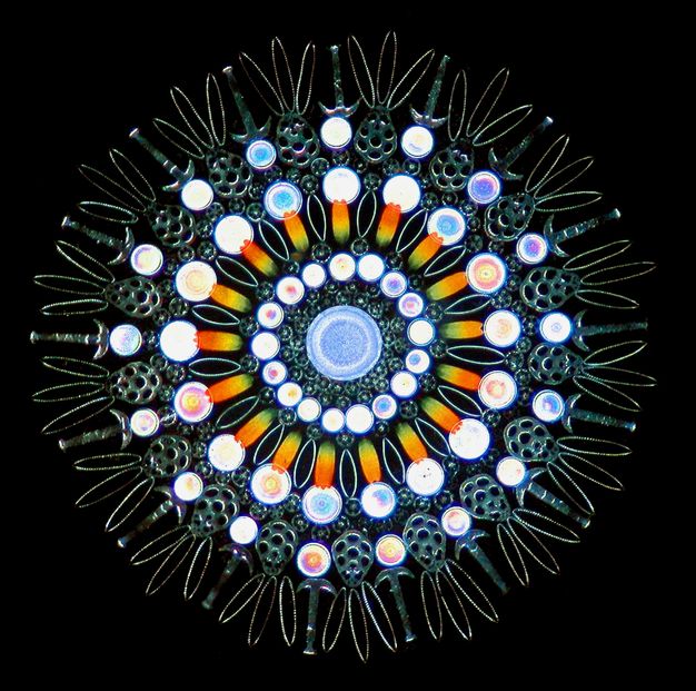 Microphotograph. Taken with the aid of a microscope, a pattern of rings, pointed ovals, and lacy structures are made of the opalescent scales of butterflies along with single-celled organisms.