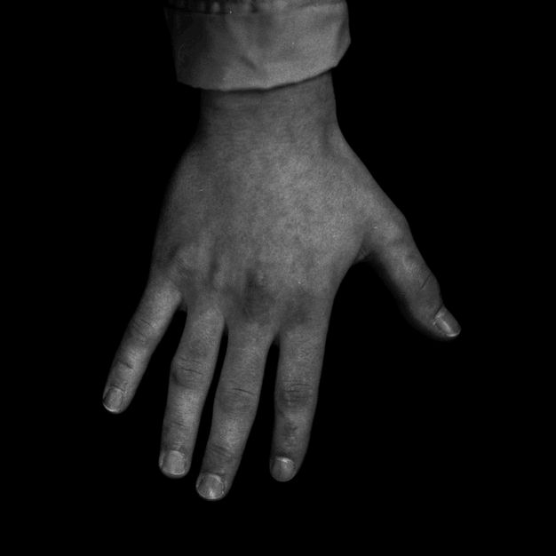 Black and white photograph. Man's hand and wrist enter the composition from centre of the top edge, showing the cuff of a slightly crinkled shirt. The man's fingernails are bitten and sore with swollen finger joints against a black background.