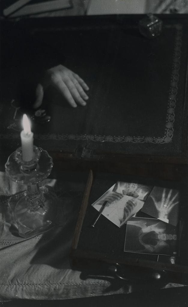Black and white photograph. A dark interior scene is lit by a small candle in a glass holder on the left, which rests on a flat chair cushion. On the right, the interior of a pulled-out desk drawer contains x-rays of a hand, a ribcage, and a pelvis. Beyond them a human hand emerges out of the darkness, resting palm down on an antique, fold-out table top.