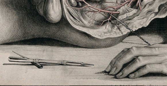 The Circulatory System: Dissection of the Abdomen and Pelvic Region of a Man, Side View, Showing the Intestines and Bladder, with the Arteries Indicated in Red (detail)